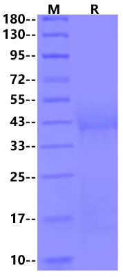 CD19 His Tag Protein, Human