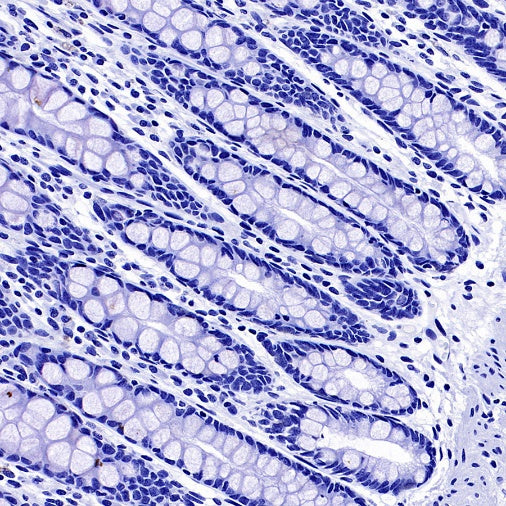 GFAP Recombinant Mouse mAb (SDT-3032)