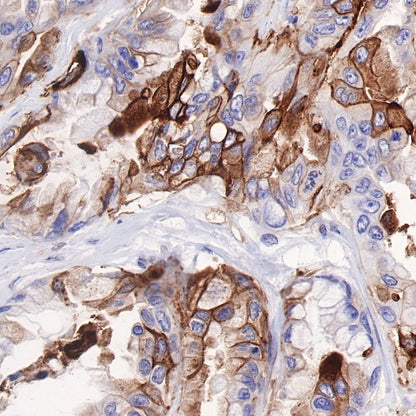 Tissue factor Recombinant Rabbit mAb (S-893-34)