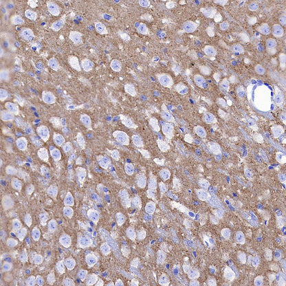 SV2A Recombinant Rabbit mAb (S-4049-16)