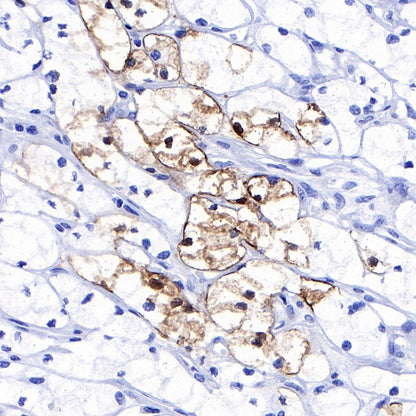 FABP7 Recombinant Rabbit mAb (S-762-41)