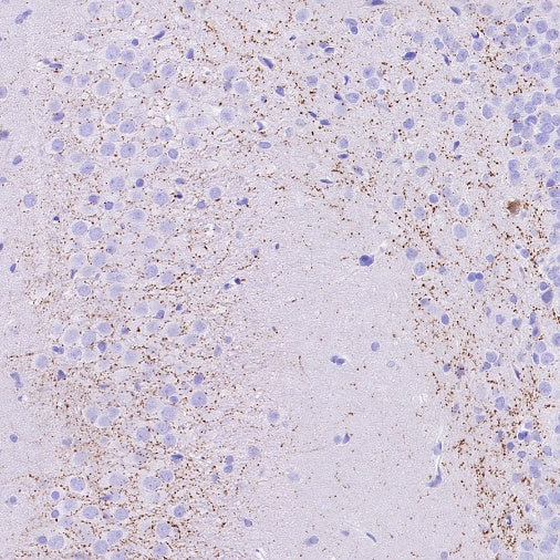 VGLUT3 Recombinant Rabbit mAb (S-2430-26)