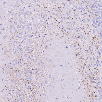 VGLUT3 Recombinant Rabbit mAb (S-2430-26)