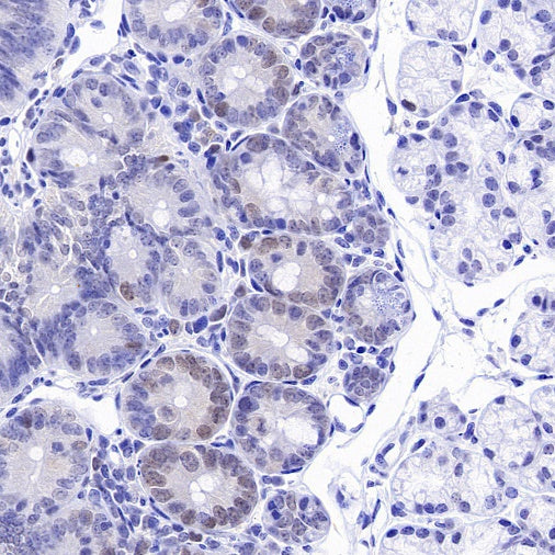 Phospho-Rb (Ser807/811) Recombinant Rabbit mAb (S-2215-52)