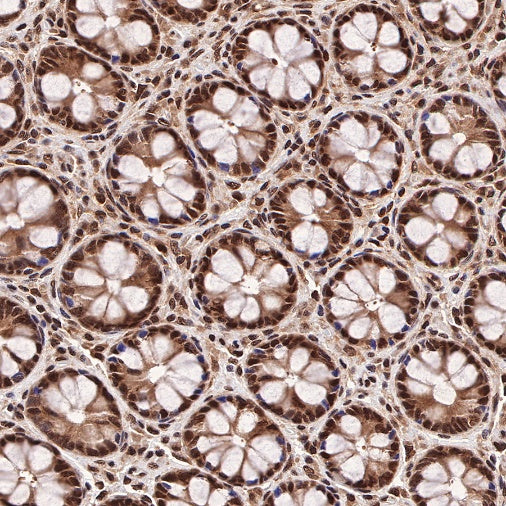 RBX1 Recombinant Rabbit mAb (S-R355)