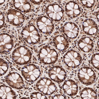 RBX1 Recombinant Rabbit mAb (S-R355)
