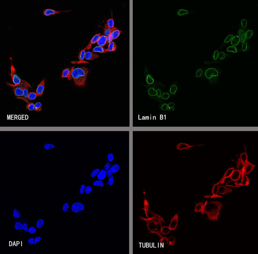 Lamin B1 Recombinant Rabbit mAb (S-5361)