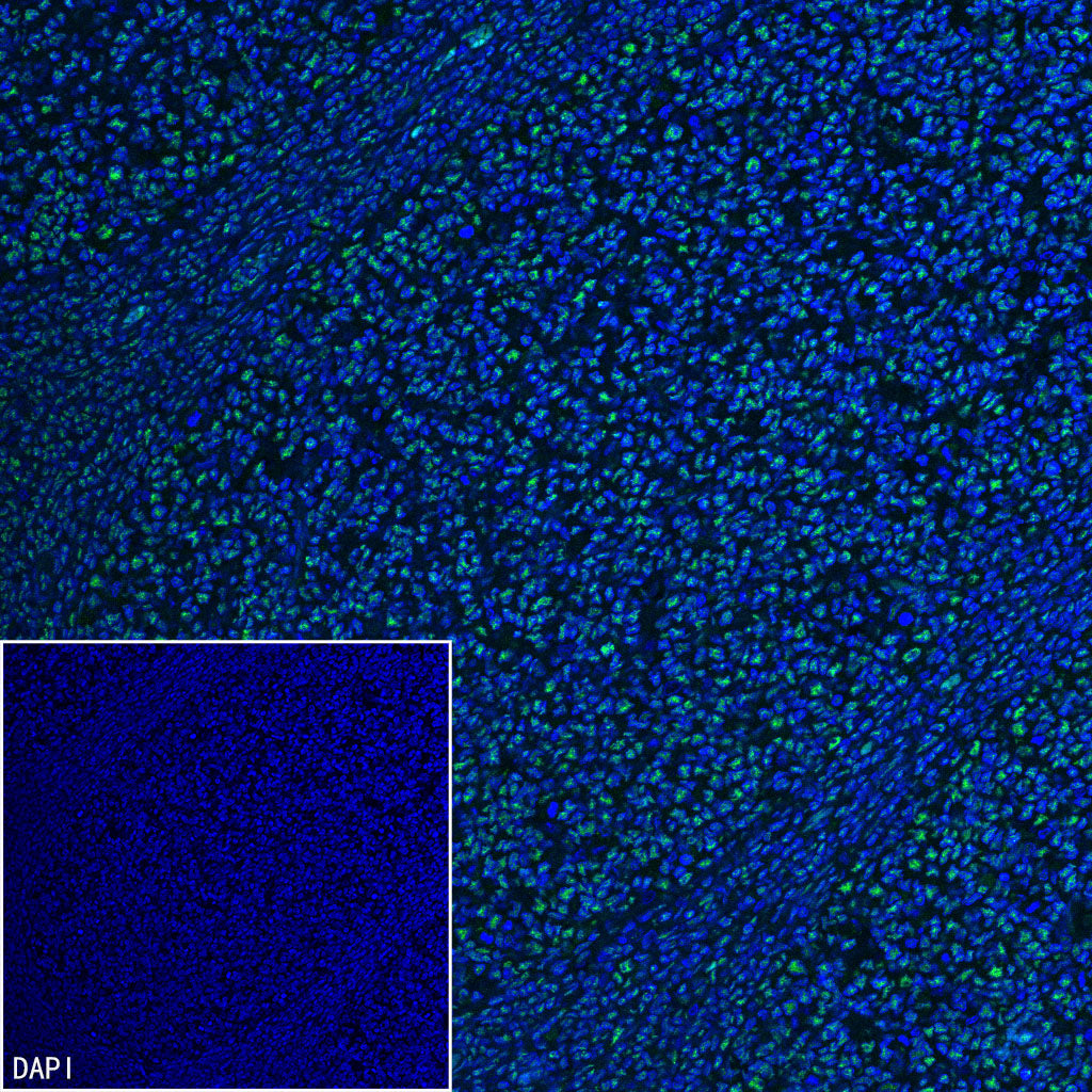 PABPN1 Rabbit Polyclonal Antibody