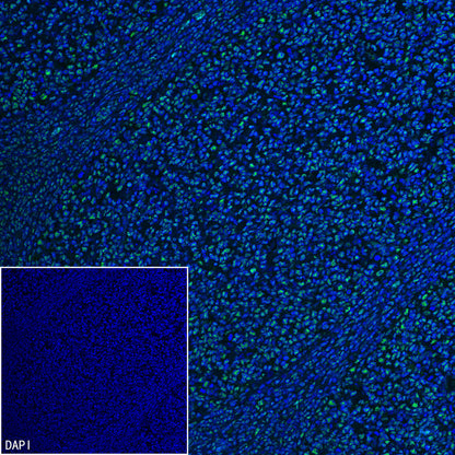 PABPN1 Rabbit Polyclonal Antibody