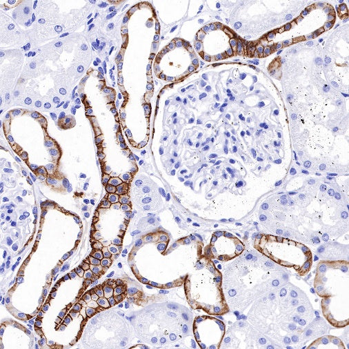 TACSTD2/TROP2 Recombinant Rabbit mAb (S-R238)