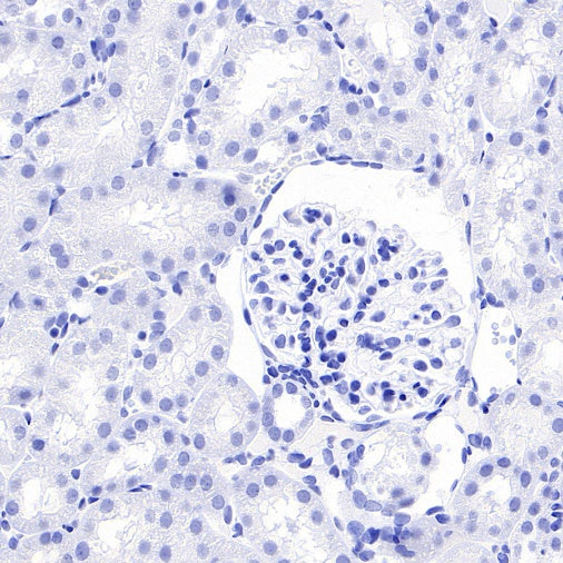 FABP7 Recombinant Rabbit mAb (S-762-114)