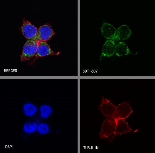 PBR/TSPO Recombinant Rabbit mAb (S-607-19)