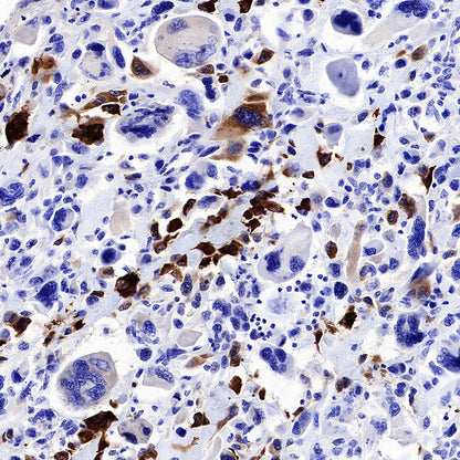 BSP II Recombinant Rabbit mAb (SDT-3508-1)
