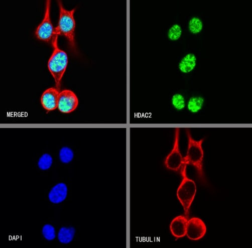HDAC2 Recombinant Rabbit mAb (S-1474-27)