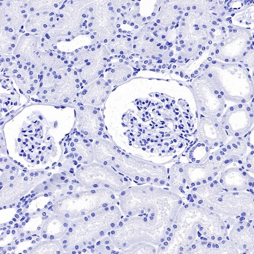 PMEL/Melanoma gp100 Recombinant Rabbit mAb (SDT-3393)