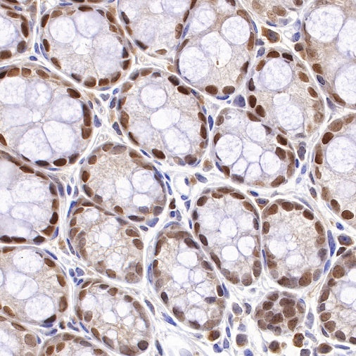 PMS2 Recombinant Rabbit mAb (SDT-111-307)