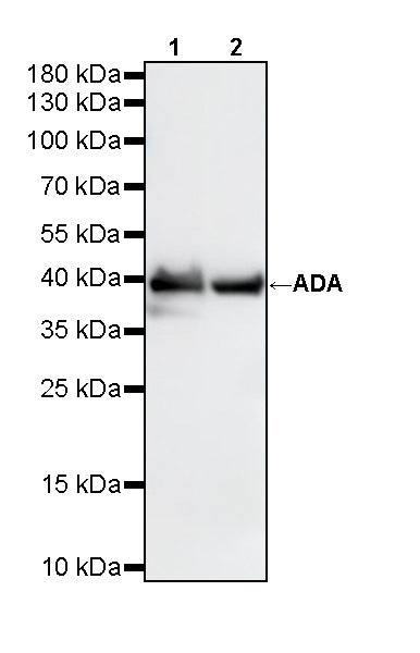 ADA Recombinant Rabbit mAb (S-5470)