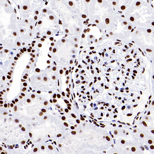 ARID1A Recombinant Rabbit mAb (S-440-27)