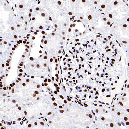 ARID1A Recombinant Rabbit mAb (S-440-27)
