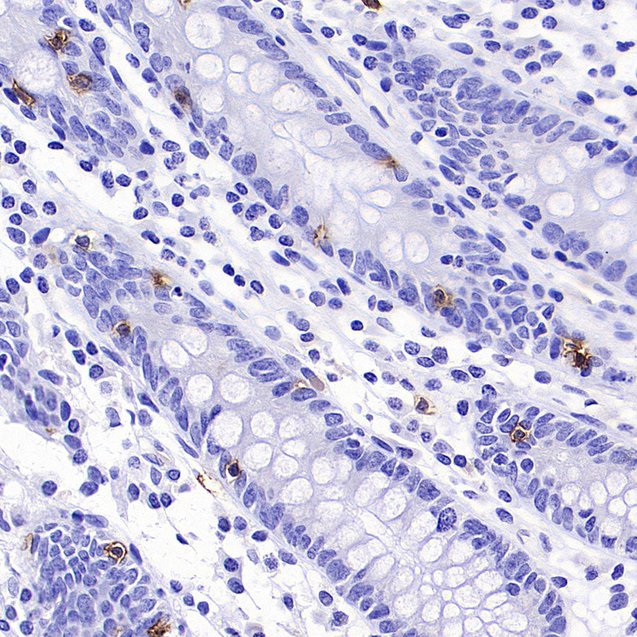 TRDC/TCR delta Recombinant Rabbit mAb (S-5148)