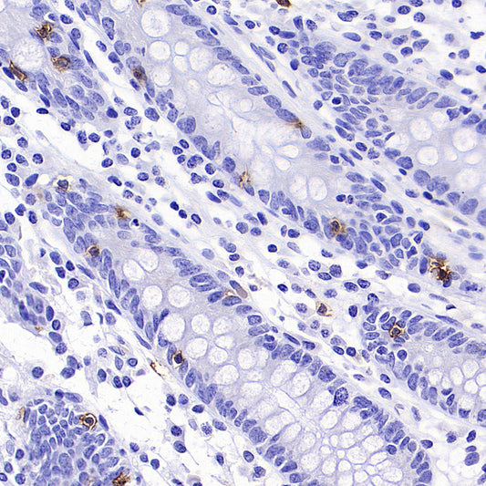 TRDC/TCR delta Recombinant Rabbit mAb (S-5148)