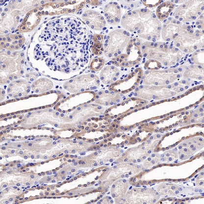 WWOX Recombinant Rabbit mAb (S-R298)