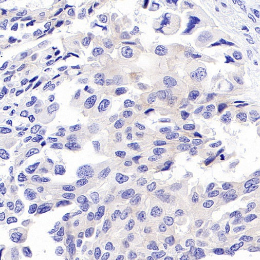 S-RMab® ErbB3 Recombinant Rabbit mAb (SDT-991-10)