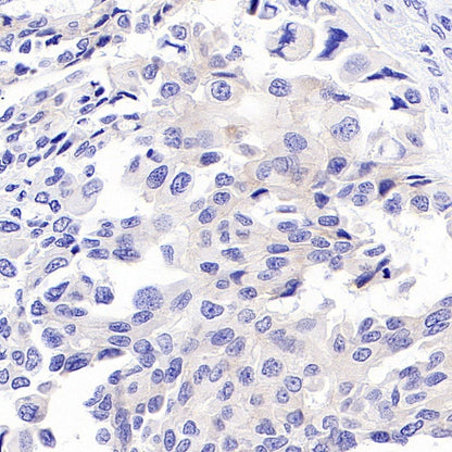 S-RMab® ErbB3 Recombinant Rabbit mAb (SDT-991-10)
