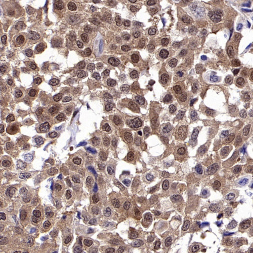 AKT2 Recombinant Rabbit mAb (S-2617-6)