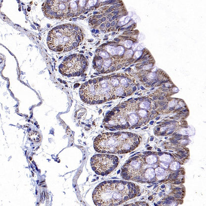 LONP1 Rabbit Polyclonal Antibody
