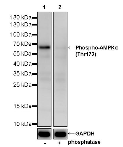 Phospho-AMPKα (Thr172) Recombinant Rabbit mAb (S-2216-10)