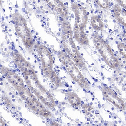 DLAT Rabbit Polyclonal Antibody
