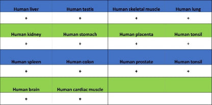 XPO1/CRM1 Recombinant Rabbit mAb (S-3309-7)