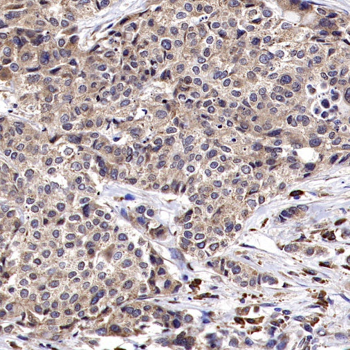 PTP1B Rabbit Polyclonal Antibody
