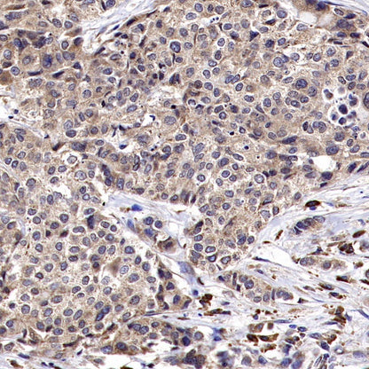 PTP1B Rabbit Polyclonal Antibody