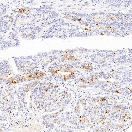 MMP7 Recombinant Rabbit mAb (S-1628-25)