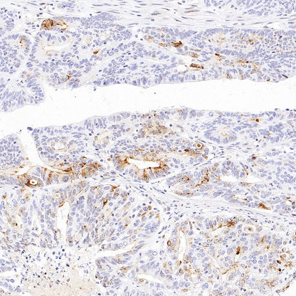 MMP7 Recombinant Rabbit mAb (S-1628-25)