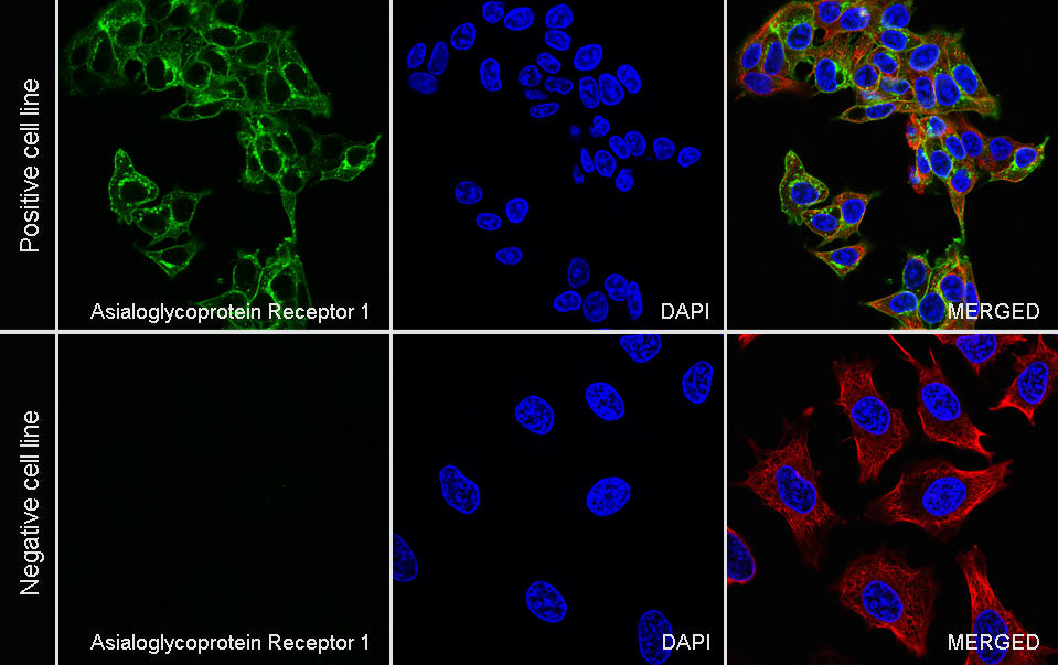 Asialoglycoprotein Receptor 1 Recombinant Rabbit mAb (SDT-292-48)