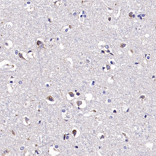 Man6P Recombinant Rabbit mAb (S-2745)