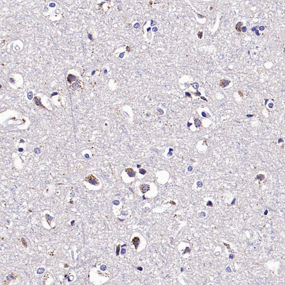 Man6P Recombinant Rabbit mAb (S-2745)