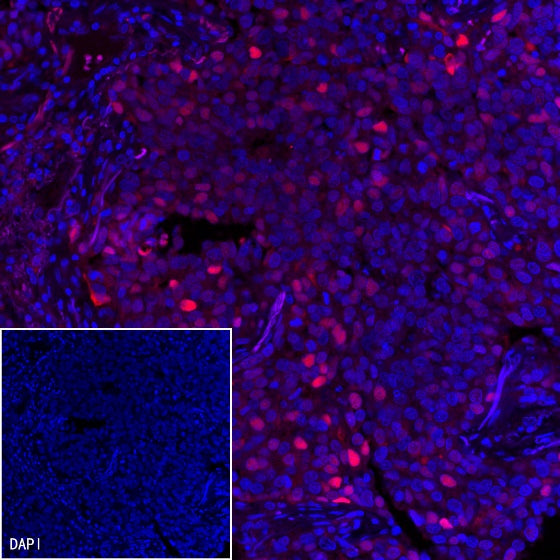 p21 Waf1/Cip1 Recombinant Rabbit mAb (SDT-1349-71)