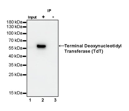 Terminal Deoxynucleotidyl Transferase (TdT) Recombinant Rabbit mAb (S-R245)