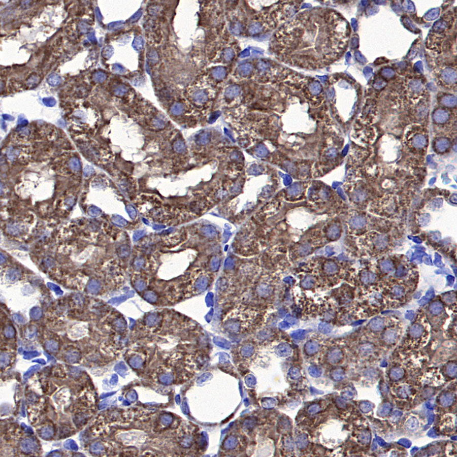 VDAC1 Recombinant Rabbit mAb (S-5314)
