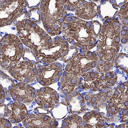 VDAC1 Recombinant Rabbit mAb (S-5314)