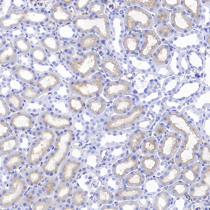 FOLR1 Recombinant Rabbit mAb (SDT-3635-124)