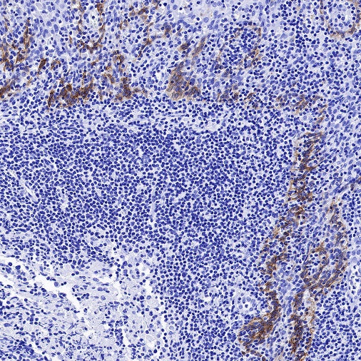 Collagen XVII Recombinant Rabbit mAb (S-1636-5)