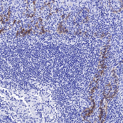 Collagen XVII Recombinant Rabbit mAb (S-1636-5)