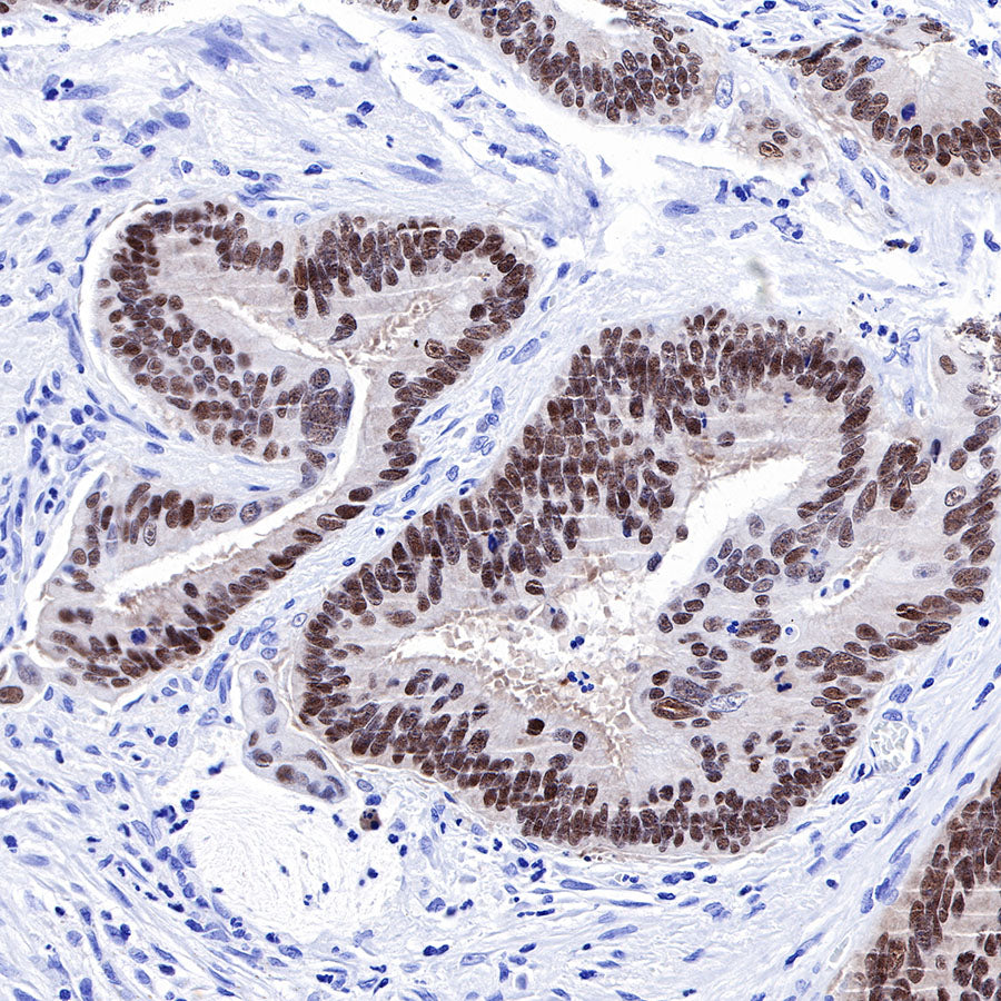 SOX9 Recombinant Rabbit mAb (SDT-019-29)
