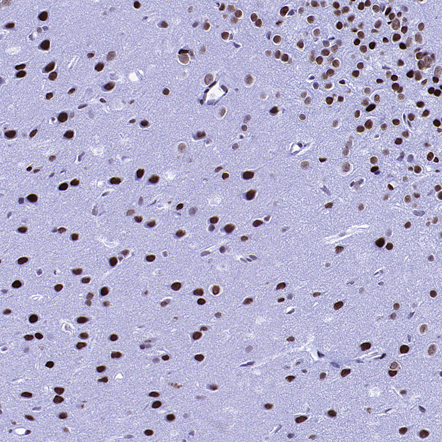 KDM2A Recombinant Rabbit mAb (S-3943-25)