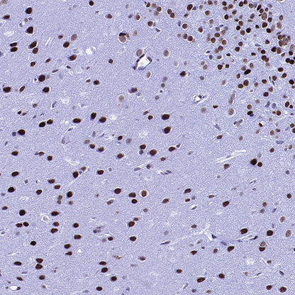 KDM2A Recombinant Rabbit mAb (S-3943-25)